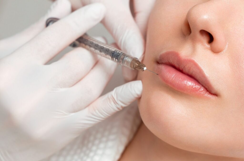 Preenchimento Labial